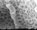 腎小球中破裂的微血管，圖中可見膜孔（掃描式電子顯微鏡，放大100,000倍）