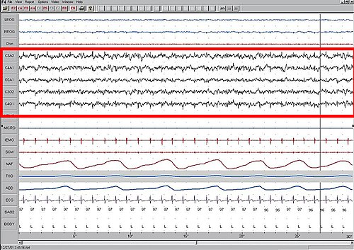 第一期睡眠，腦電圖（EEG）以紅框凸顯