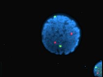 螢光原位雜合技術（FISH），絲粒探針雜交，人類淋巴細胞核染色，螢光染料 (DAPI)，13號染色體（綠色）和21號染色體（紅色）
