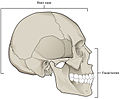 腦顱（標為「Brain case」）與顏面骨（英语：Facial skeleton）。
